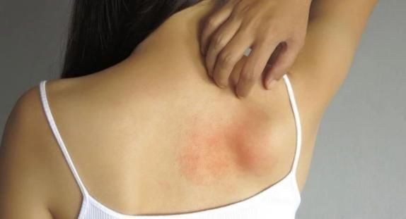 体毛|女性这3处毛发旺盛,是好还是不好?可能跟你想得不一样