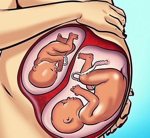 怀孕中可以再怀孕一次吗 她10天怀孕2次还成功生下来