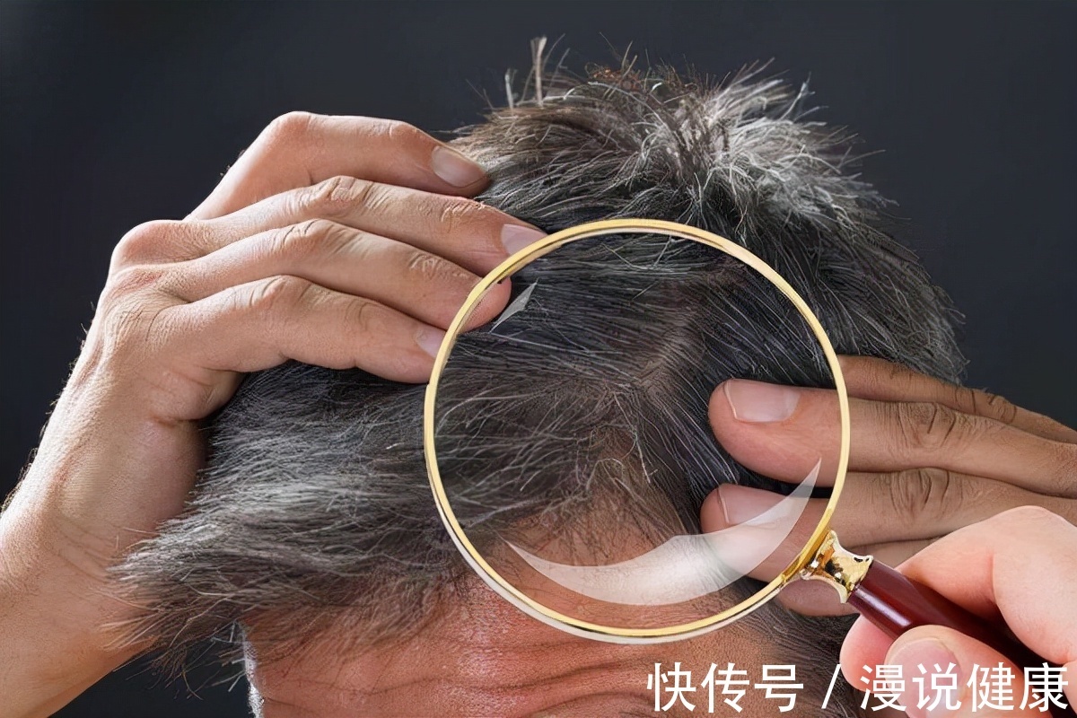 白发|80岁都能去除白头发?被追捧的网红洗发水,实则只是一个智商税