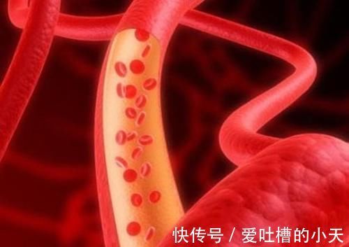 饮酒|很多人说喝酒会患高血压,有人喝了一辈子酒,为何血压却很正常?