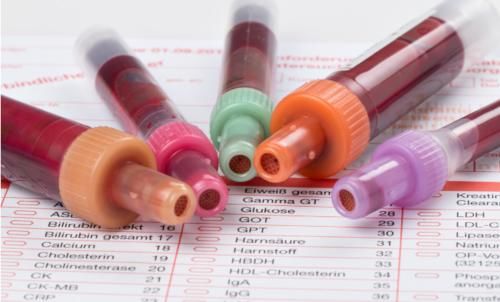 嘌呤|辟谣——“尿酸高”就是有“痛风”？要尽快降尿酸？医生：并不是