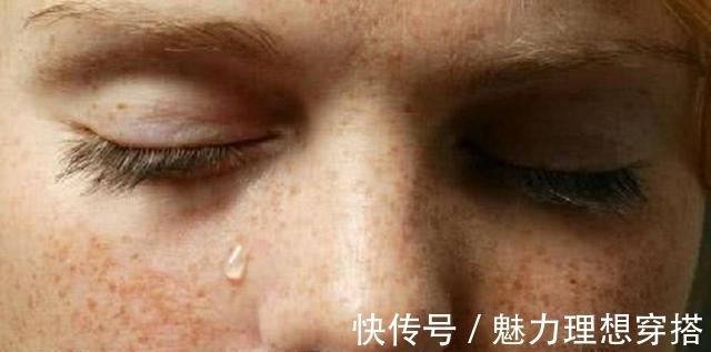 脸部|女性脸部有4个“症状”别马虎,可能得了妇科病,要足够重视