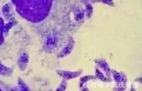 宠物|孩子头上长猫藓怎么办?