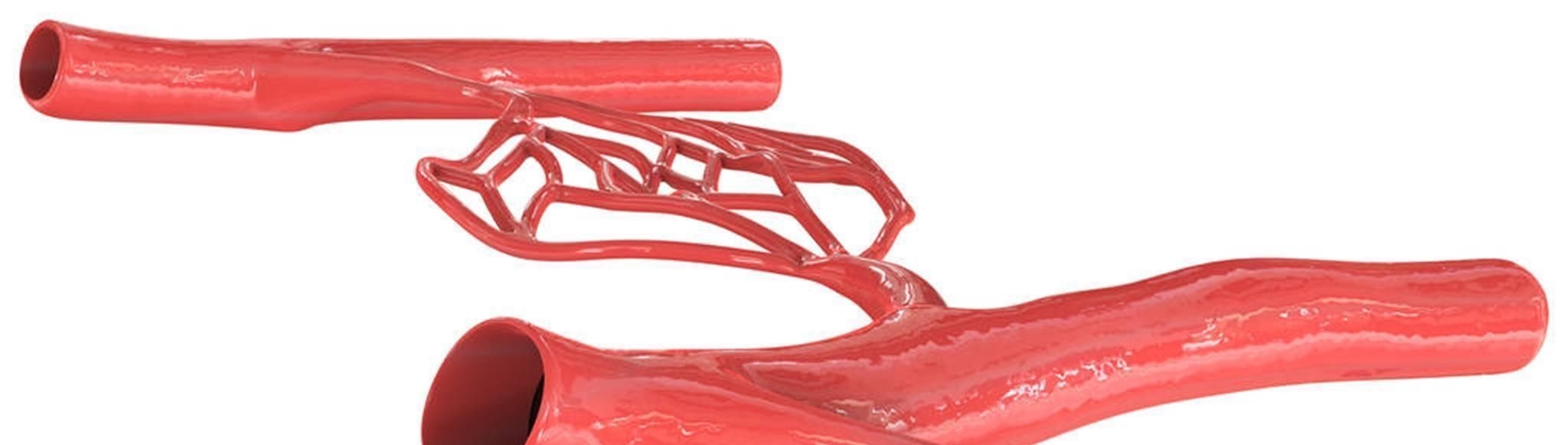 血管|高血脂的“祸根”找到了,若想稳定血脂,吃2物,戒1习,保护血管