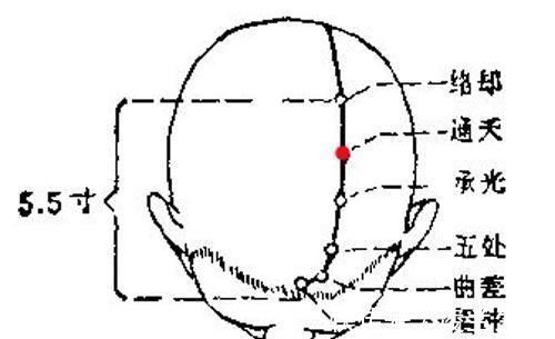 穴位|5大穴位扶阳正气,再顽固的鼻炎,这样简单调理也很快痊愈了!