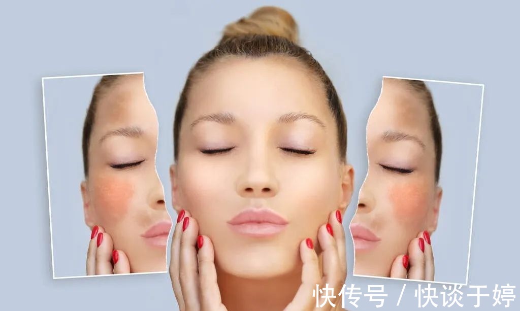 肌肤|肌肤屏障受损,多数因为护肤习惯差!