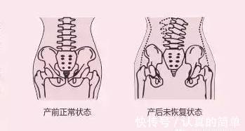 不良习惯|骨盆后旋对身体的伤害你知道吗？