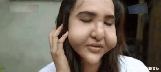 整容手术|三姐妹做整容手术只花100元，结果令她们后悔不已