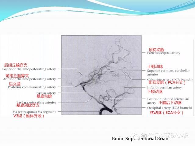 mr|椎-基底动脉系统解剖