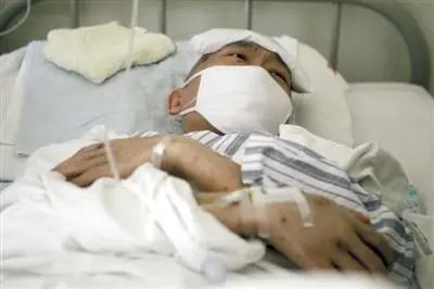 白血病|甲醛是致癌物，5种食物携带甲醛，请趁早远离