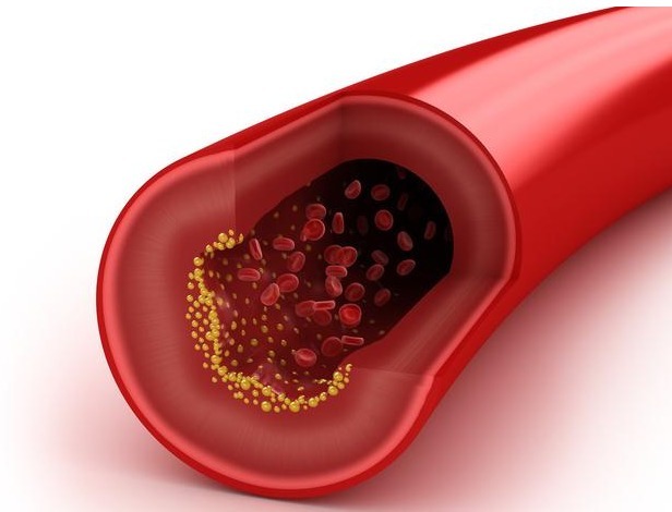 碳水化合物|糖尿病的“罪魁祸首”并不是甜食，若再不忌口，血糖越升越快