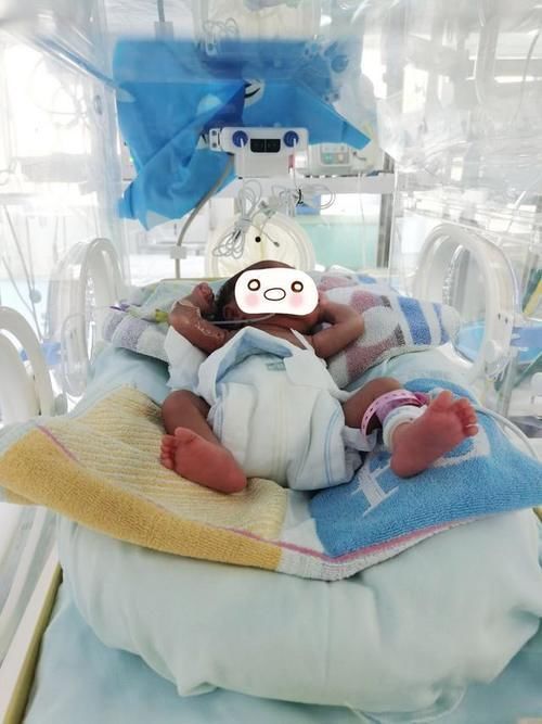 早产|守护生命,市妇幼保健院成功救治两名早产低体重儿