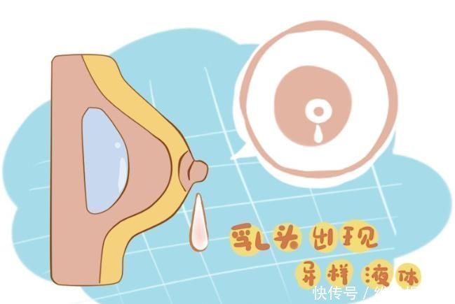 乳头|女性乳腺癌发作前,身体会发出这6种异常信号,越早发现越好