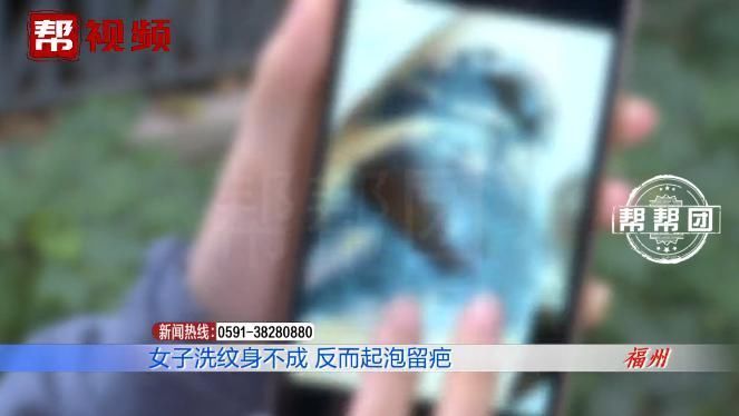 皮肤起泡化脓留疤,医生提醒,做这事得谨慎!