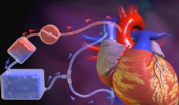 血脂|高血脂人群,牢记:常吃1物,稳定血脂清理血管,赶走健康隐患!