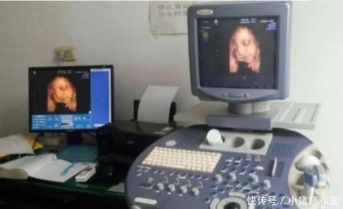 检查|四维B超产检孕妈满心期待,医生模棱两可的话,让妈妈猜了好几天