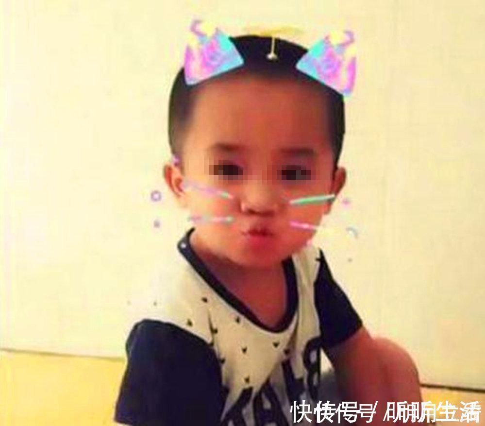 亲妈|5年过去,因吃奶太用力被亲妈“毁容”的婴儿现状如何?令人欣喜