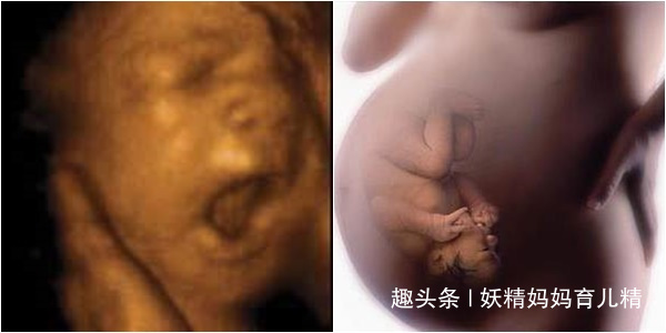 胎动|孕期胎动透漏宝宝的性格,各有优点,你家属于哪一种