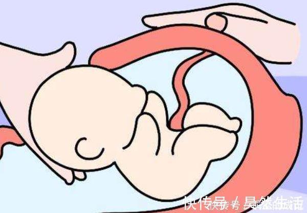 剖宫产术|女性的子宫能“扛”几次剖腹产超过这个次数,千万不要再剖了