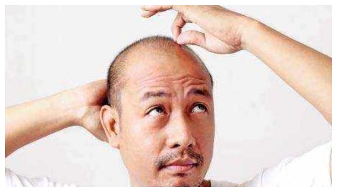 睡眠质量|雄性激素较高的男人,身上通常有3种共性,若全中,恭喜