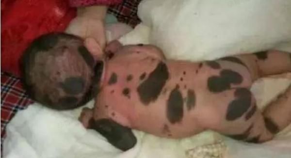 宝宝|怀孕的妈妈想生儿子,就吃下所谓的“转胎丸”,宝宝出生时悲剧了