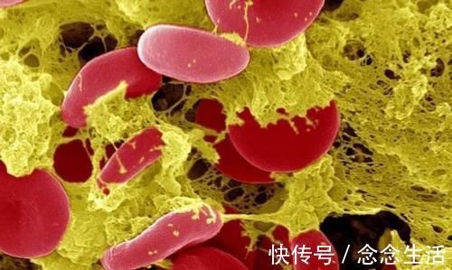 诱发|血液稠不稠,主要看4点,牢记“3要3不要”,血管畅通人长寿