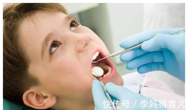 磨牙|窝沟封闭做一次可以保护一辈子?