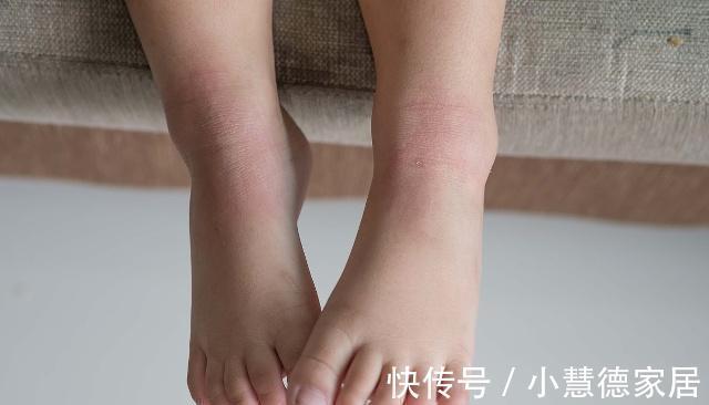 尿酸含量|晚上睡觉若有此些变化，可能是体内尿酸升高了，尽量别大意了