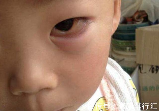 妈妈|5个月孩子眼睛几乎失明，妈妈几度失控：都怪我太溺爱孩子了