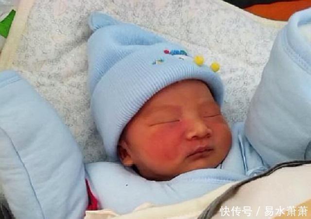 李女士|为什么有的宝宝会有“胎记”产科医生孕期要避免这3种行为