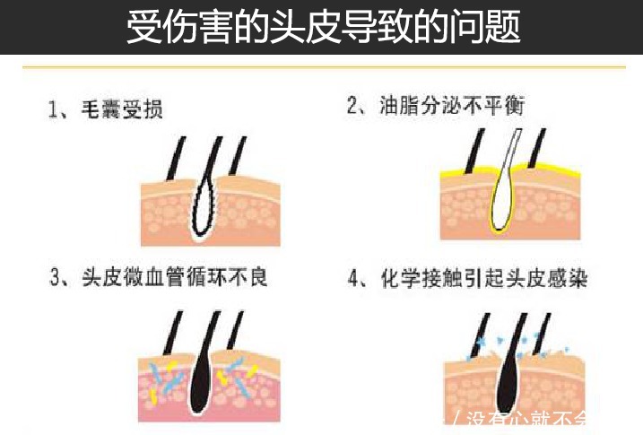 脱发|硫磺香皂可以洗头吗？用硫磺皂洗头会脱发吗？（配图深度分析）