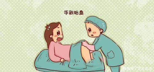 人工流产|5种产妇容易'手剥胎盘',第4种引发几率高,孕妈别忽视