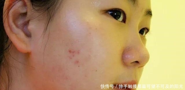 校花|初中女生变“丑”的3个真相,最后一个无法反驳,校花都躲不掉