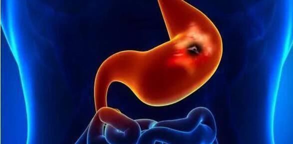 天然的养胃王找到了, 常吃修复胃粘膜,