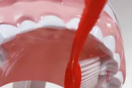 刷牙|5岁男孩突发急性肾炎，病根竟然是在口腔里