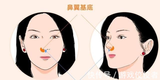 美者 鼻基底对面部影响有多大鼻基底凹陷如何改善_芯动医美课堂!