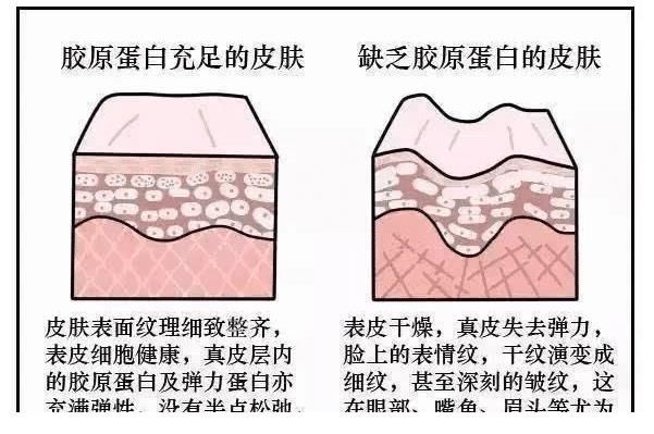 皮肤|为变美做“脂肪填充”的女人，如今变啥样了？过来人：还不如不做