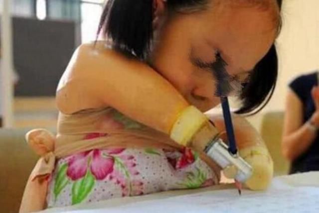 美芽|执迷不悟，孕检发现胎儿“没手没脚”，宝妈：我会爱他，我要生