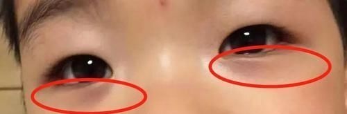 脾胃|3岁女孩一年猛窜28公分,方法是做3事健脾胃,长高又长肉