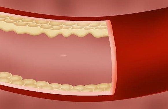 血型|A型B型O型和AB型血,各有什么优势为何说O型血是最强血型