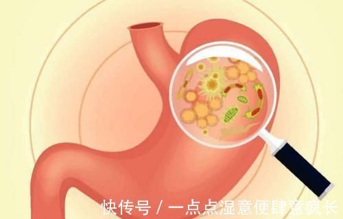 幽门螺杆菌|幽门螺杆菌的“敌人”，没事喝一口，修复胃黏膜，甩掉多年老胃病