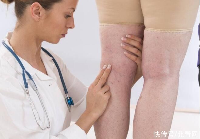 近期腿部反复有以下三个症状，这就可能是癌变的信号