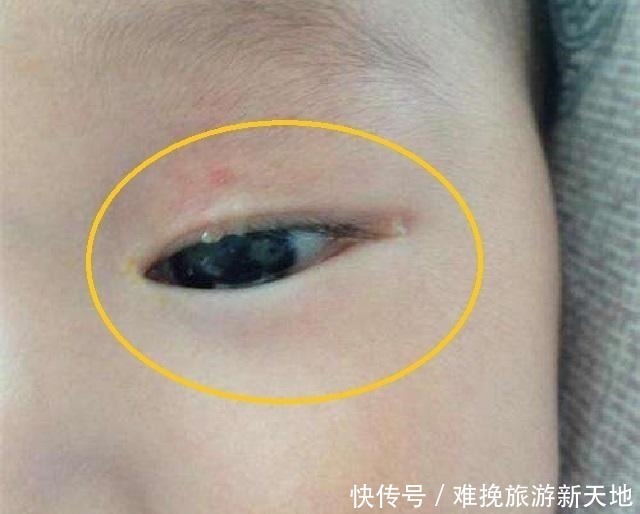 失明|宝宝眼睛差点失明，“罪魁祸首”是这种玩具，宝妈知道后后悔不已