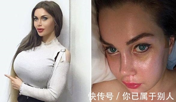 美国 美国一女子去韩国做危险极高的额骨手术,还说整容上瘾