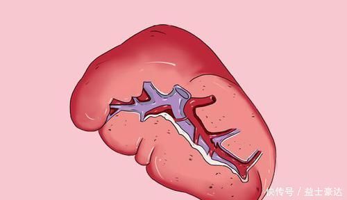 專(zhuān)家|脾虛百病來(lái)擾!該如何判斷脾虛?專(zhuān)家:牢記3個(gè)提醒就好