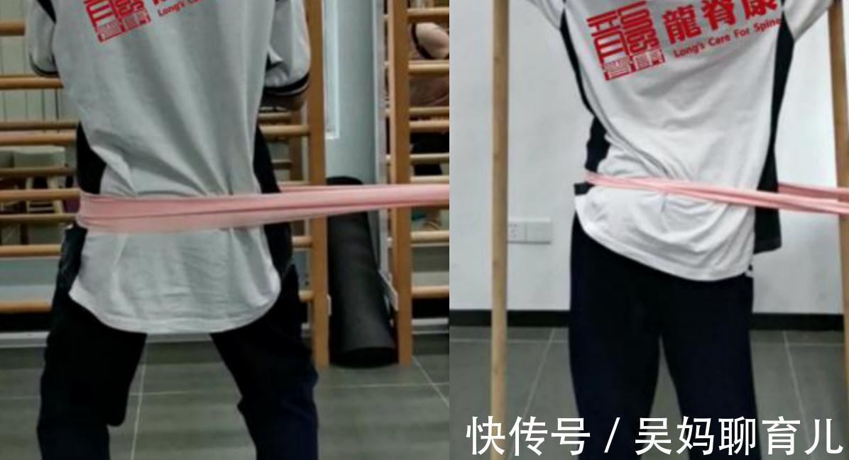 小陈|孩子出现高低肩、身体偏歪?小心这可能是脊柱侧弯惹的祸