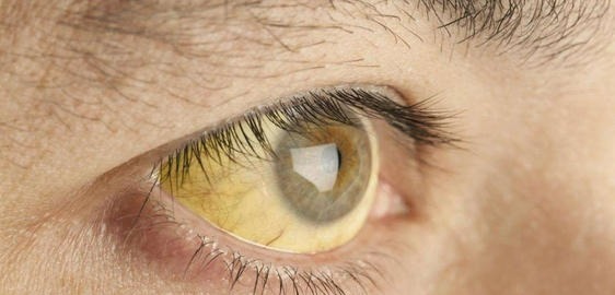 肝脏|肝好不好,看这4个部位,少吃3种食物,做好2件事,肝会越来越好