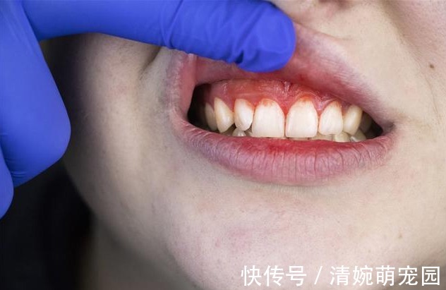 西兰花|肝不好的人,忌口“三白”,常吃“四绿”,肝一天比一天好