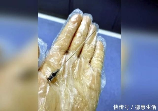 针头|剖腹产比顺产轻松?看完这些“手术工具”,别再说女人“矫情”