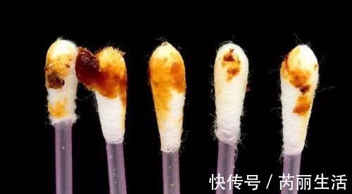 鼻屎白色粘稠怎么回事